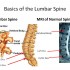 lumbar-spine-ppp