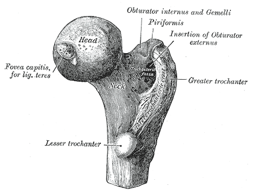 Femur_head